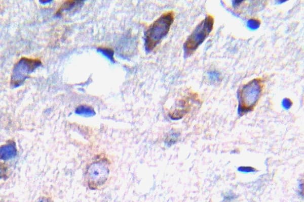 PDGFRB / PDGFR Beta Antibody (phospho-Tyr751)