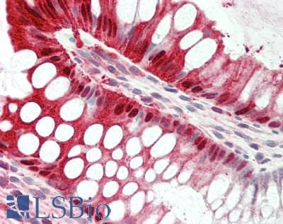 EGLN2 / PHD1 Antibody (C-Terminus)