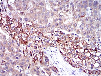 FGG / Fibrinogen Gamma Antibody (clone 4H9)