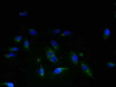 Polyclonal Rabbit anti-Human TSAP6 / STEAP3 Antibody (IHC, WB)