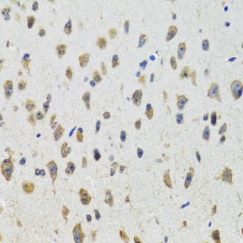 Polyclonal Rabbit anti-Human CYP19 / Aromatase Antibody (IHC, WB)