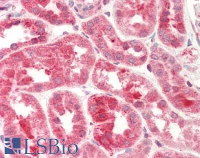Polyclonal Rabbit anti-Human CPVL Antibody (aa231-280, IHC, WB)