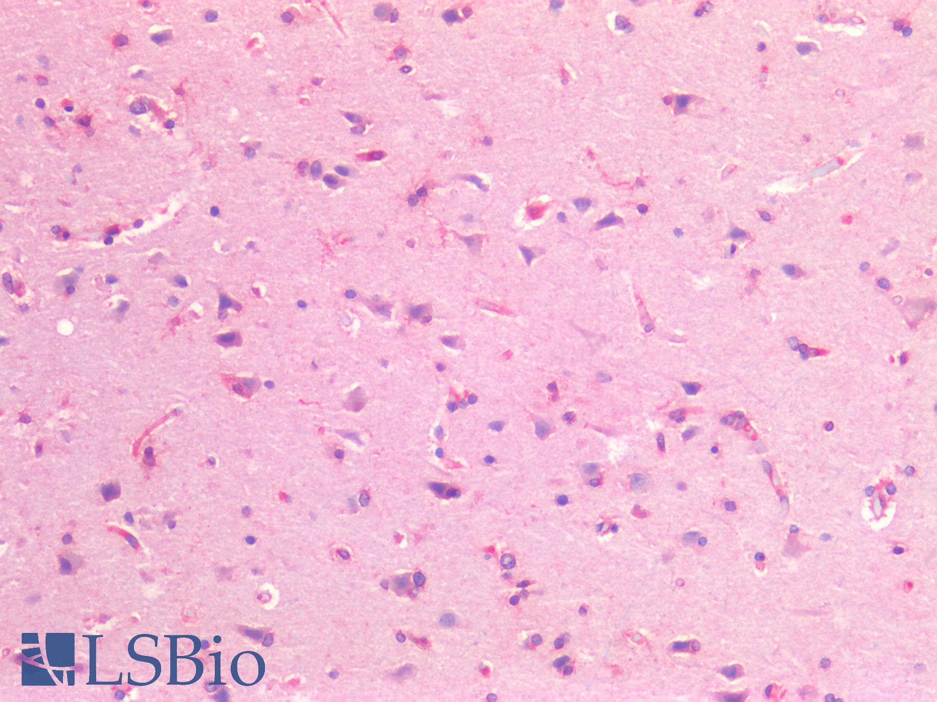 IHC-plus™ Kinesin Heavy Chain / KIF5B Antibody