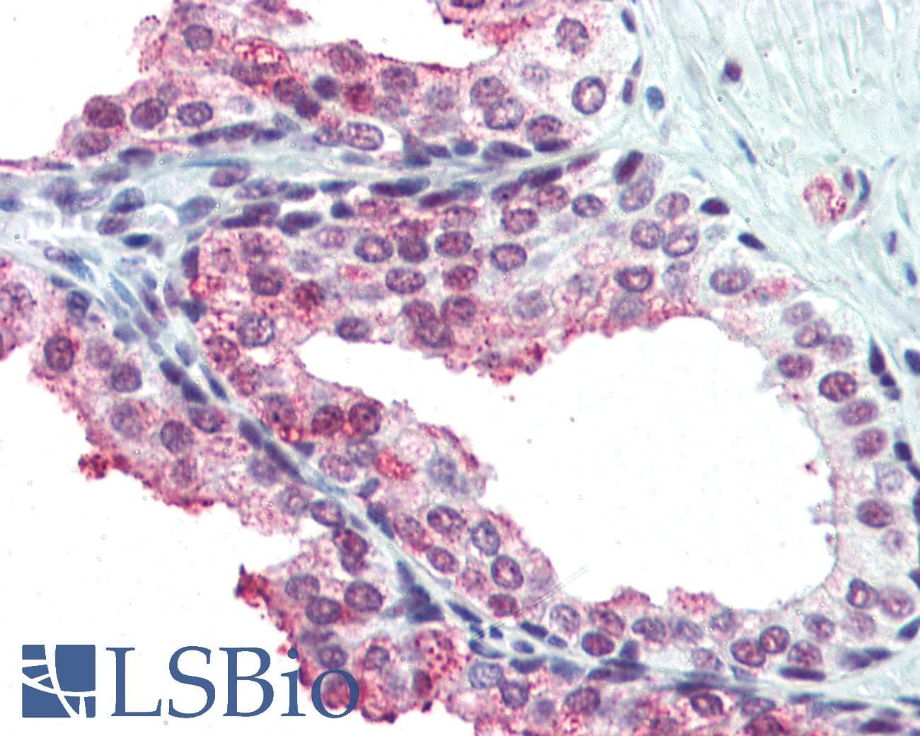 IHC-plus™ GTF2I / TFII I Antibody