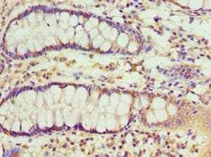 RBX1 / ROC1 Antibody (aa1-108)