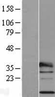 Human RPL29 / Ribosomal Protein L29 (Over-Expression Lysate Myc-DDK (Flag))