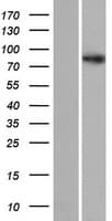 Human SDCCAG8 Protein (Over-Expression Lysate Myc-DDK (Flag))