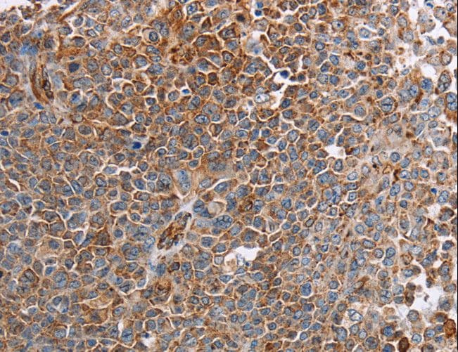 PLXNA2 / Plexin A2 Antibody