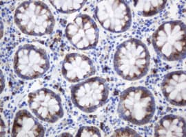 c-Kit / CD117 Antibody (aa546-976, clone OTI2C1D5, Carrier-free)