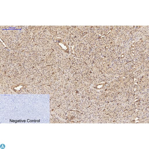 TUBA1B / Tubulin Alpha 1B Antibody