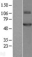 TRMT61B Protein (Over-Expression Lysate Myc-DDK (Flag))