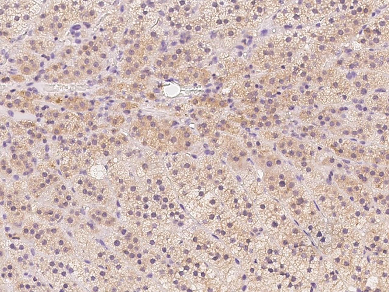 Polyclonal Rabbit anti-Human RET Antibody (IHC)