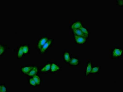 KRT18 / CK18 / Cytokeratin 18 Antibody