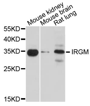 IHC-plus™ IRGM / LRG-47 Antibody