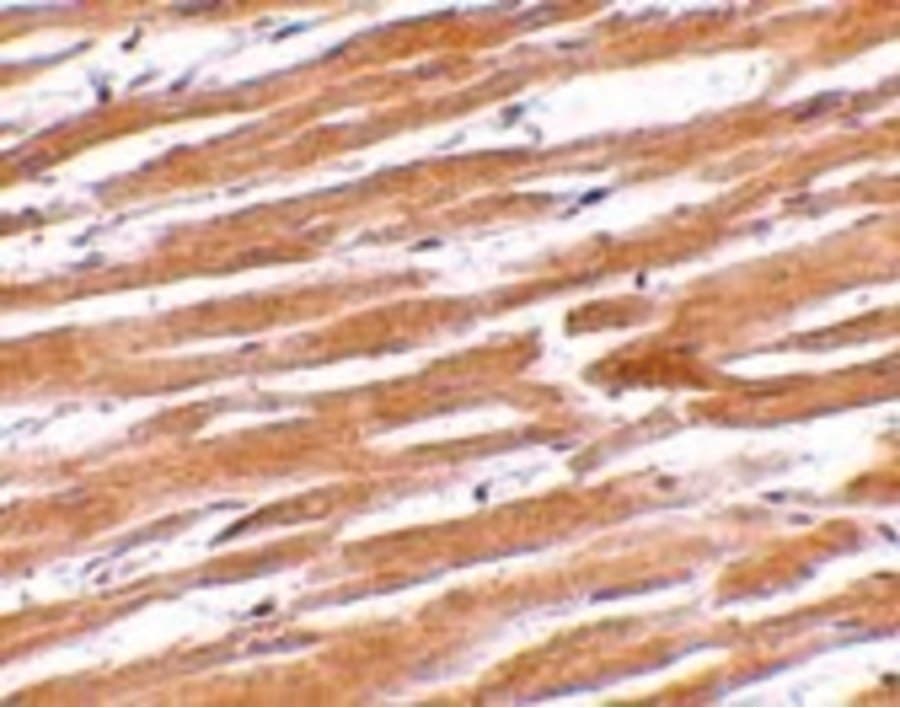 GP6 / GPVI Antibody