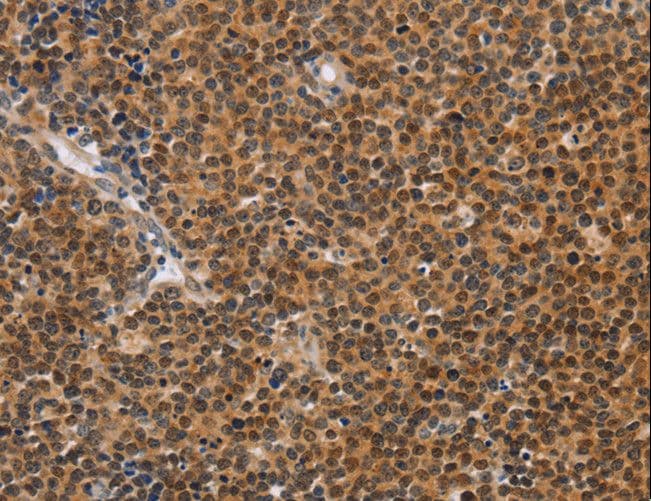 CD36 Antibody