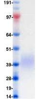 Human CD47 Protein (Recombinant DDK (Flag)-His, C-terminus)