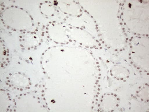 MMP2 Antibody (aa228-507, clone OTI4A11)