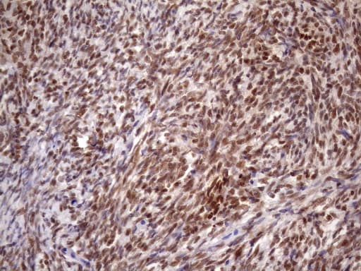 Monoclonal Mouse anti-Human BTEB / KLF9 Antibody (clone OTI8A11, IHC, WB)