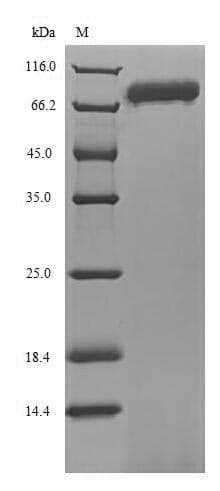 Human ENOX1 / CNOX Protein (Recombinant 6His, N-terminus)