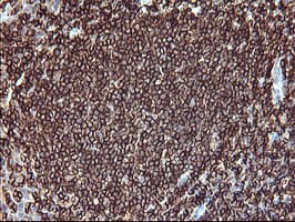 CD45 / LCA Antibody (clone OTI1F6)