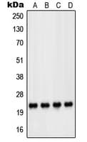 PARK7 / DJ-1 Antibody (Internal)