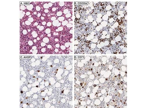 AHSP / EDRF Antibody (Liquid)