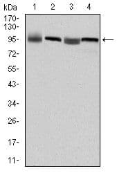 EEF2 / Elongation Factor 2 Antibody (clone 5B6)
