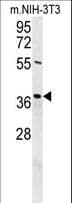 Polyclonal Rabbit anti-Human EXO5 / Exonuclease 5 Antibody (aa166-193, WB)