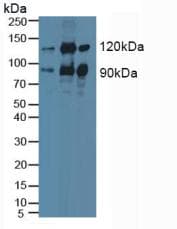PRKCE / PKC-Epsilon Antibody (aa403-672, APC)