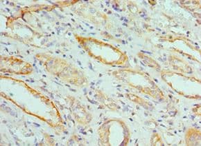 Polyclonal Rabbit anti-Human FGF1 / Acidic FGF Antibody (aa16-155, IHC)