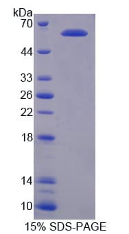 Human PIAS3 Protein (Recombinant His-GST)