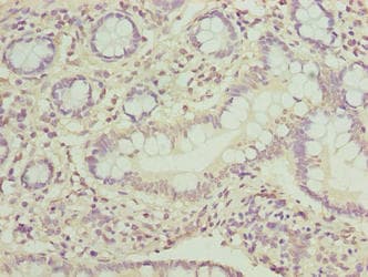 PPIL3 Antibody