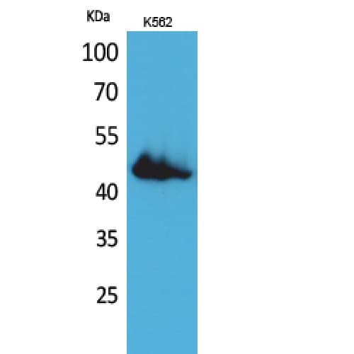 Polyclonal Rabbit anti-Human CD177 Antibody (351-400 aa, Internal, WB)