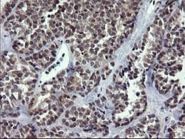 RAB37 Antibody (clone OTI2F1)