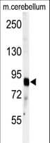 ADAMTS4 Antibody (aa705-736)