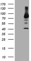 PFKP Antibody (clone OTI3H8)