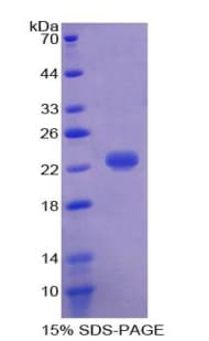 Bovine HP / Haptoglobin Protein (Recombinant His-T7)