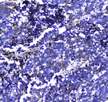 Polyclonal Rabbit anti-Human MAC-2-BP / LGALS3BP Antibody (IHC, WB)