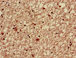 HABT1 / ABT1 Antibody