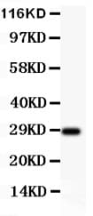 Polyclonal Rabbit anti-Human BDNF Antibody (aa129-247, IHC, WB)