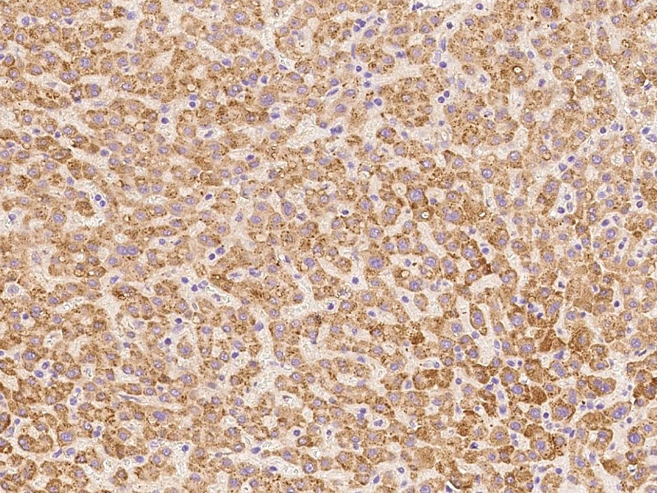 Polyclonal Rabbit anti-Human DHRS4 / PSCD Antibody (IHC, WB)