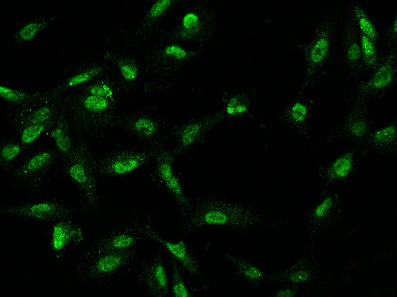 GPATCH11 / CCDC75 Antibody