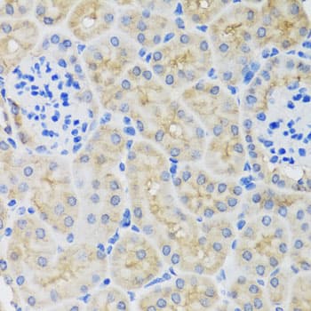 SULT1A1 / Sulfotransferase 1A1 Antibody