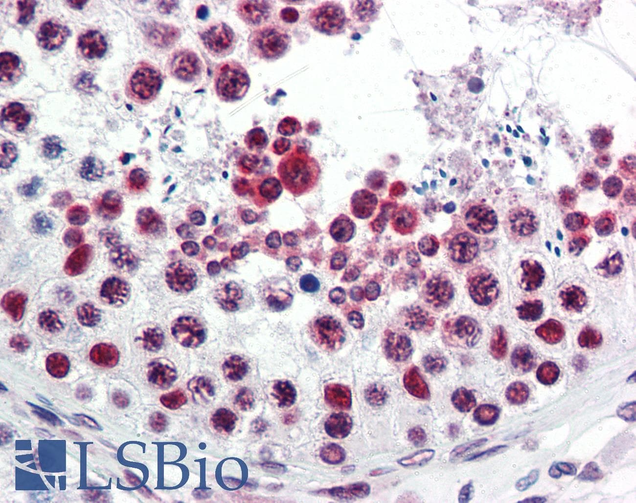 IHC-plus™ ATF6 Antibody