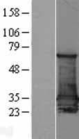Human SFN / Stratifin / 14-3-3 Sigma Protein (Over-Expression Lysate Myc-DDK (Flag))