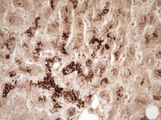 ERBB3 / HER3 Antibody (clone OTI3E10)