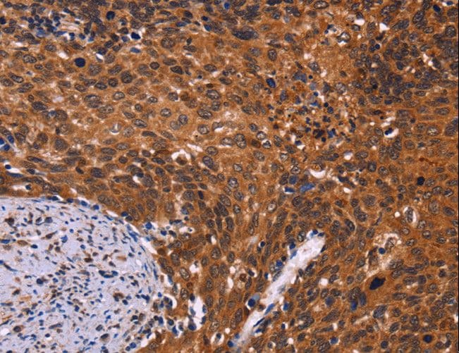 Polyclonal Rabbit anti-Human CDC5 / CDC5L Antibody (IHC)