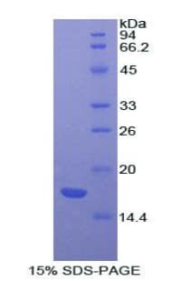 Bovine ACVR2 / ACVR2A Protein (Recombinant His)