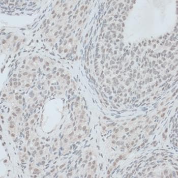 ZNF416 Antibody